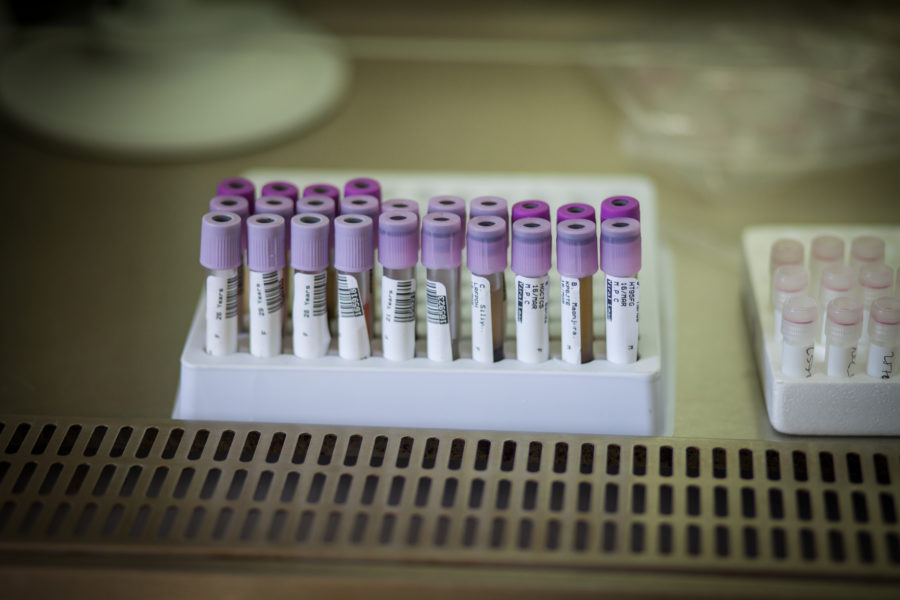 Landmark HIV Diagnostic Access Program Will Save US$150M