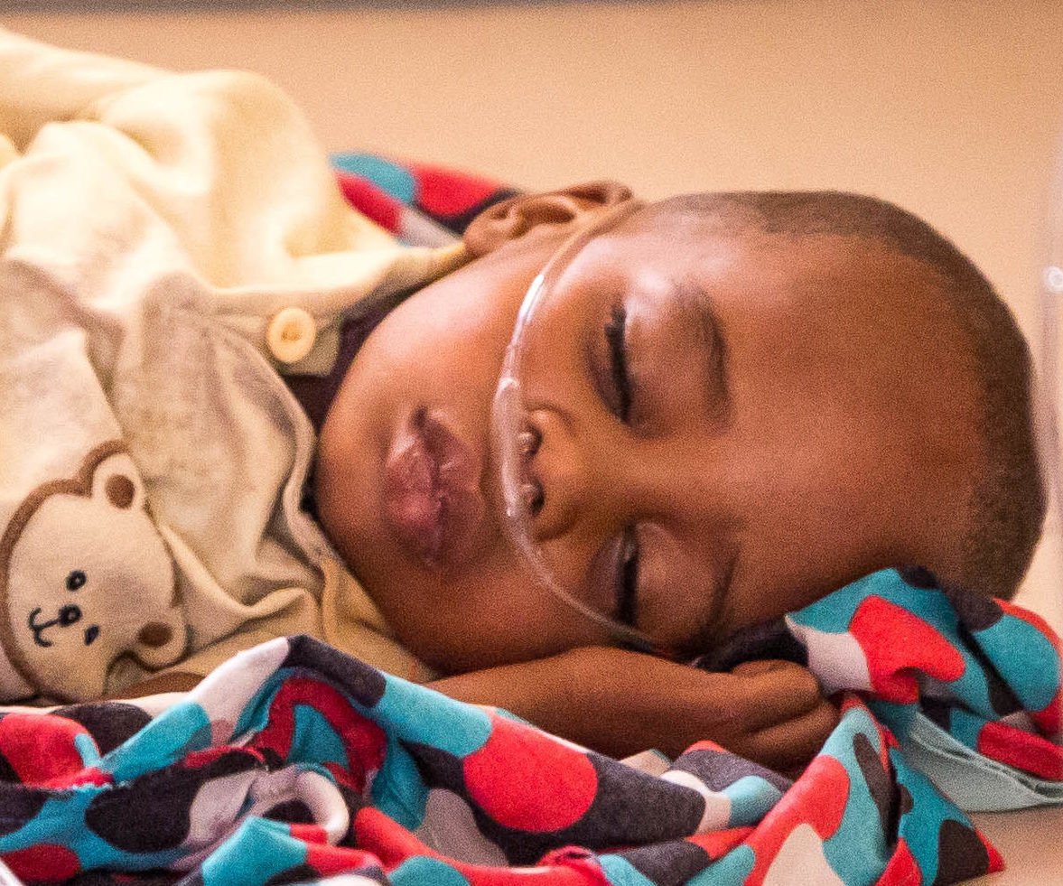 A toddler lies on a blue and red blanket with his eyes closed. He is receiving oxygen.